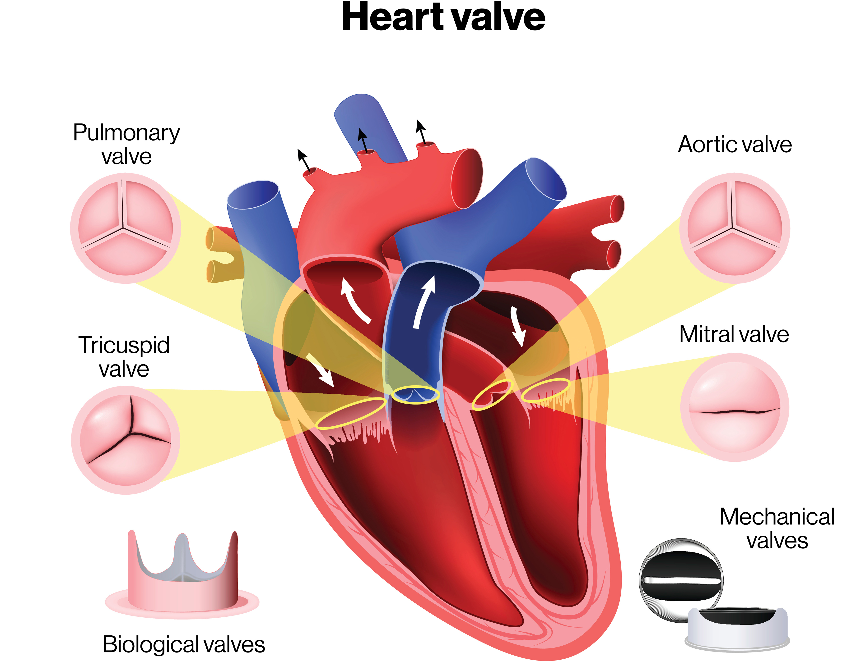 Valvular heart disease Heart and Stroke Foundation